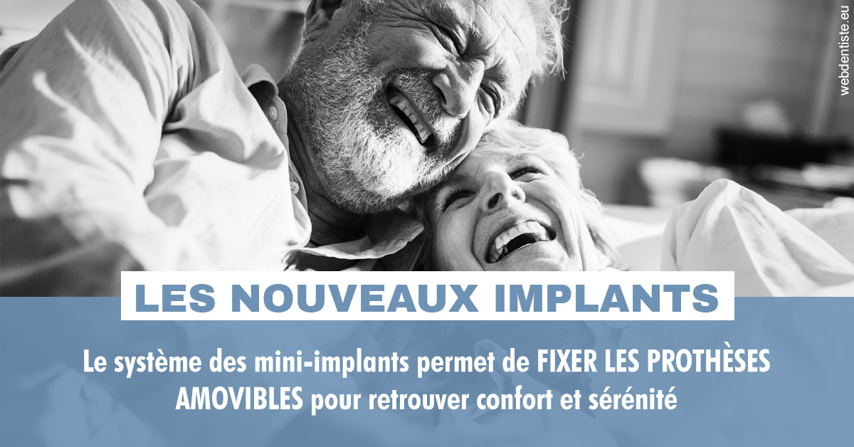 https://dr-julia-olivier.chirurgiens-dentistes.fr/Les nouveaux implants 2