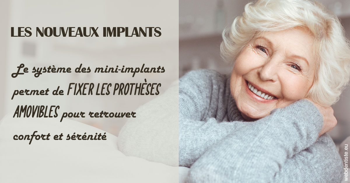 https://dr-julia-olivier.chirurgiens-dentistes.fr/Les nouveaux implants 1