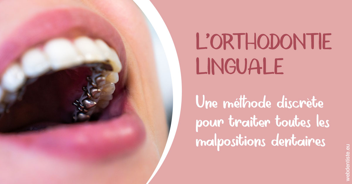 https://dr-julia-olivier.chirurgiens-dentistes.fr/L'orthodontie linguale 2