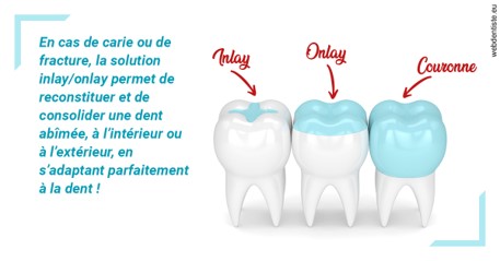 https://dr-julia-olivier.chirurgiens-dentistes.fr/L'INLAY ou l'ONLAY
