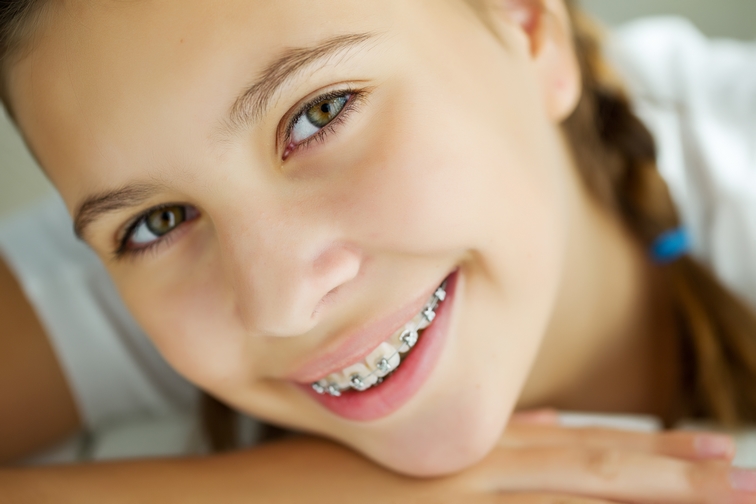 L'orthodontie invisible pour les adolescents, enfin une réalité