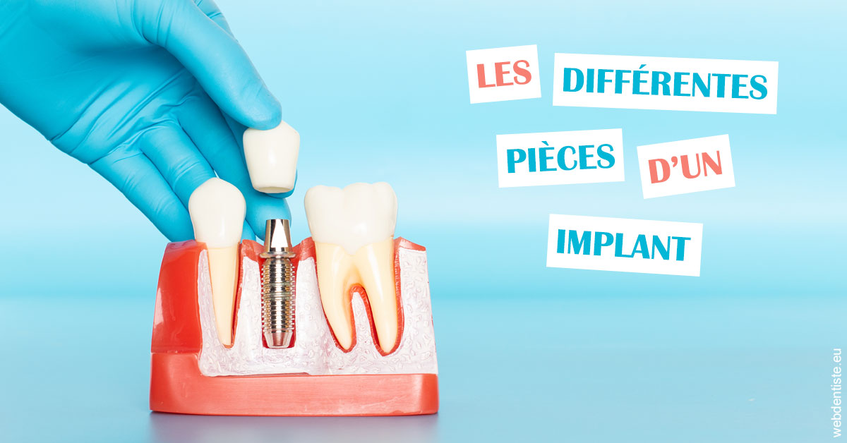 https://dr-julia-olivier.chirurgiens-dentistes.fr/Les différentes pièces d’un implant 2