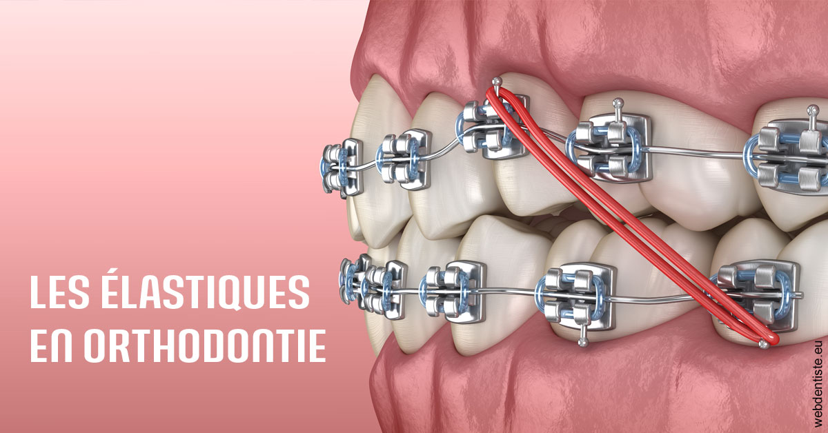 https://dr-julia-olivier.chirurgiens-dentistes.fr/Elastiques orthodontie 2