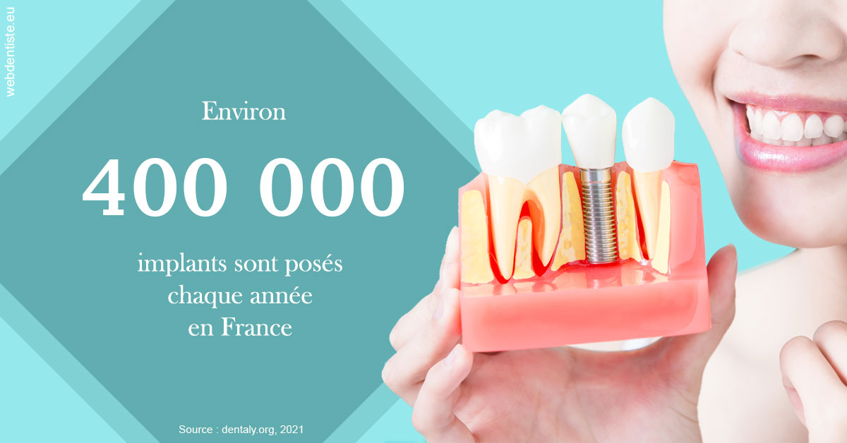 https://dr-julia-olivier.chirurgiens-dentistes.fr/Pose d'implants en France 2